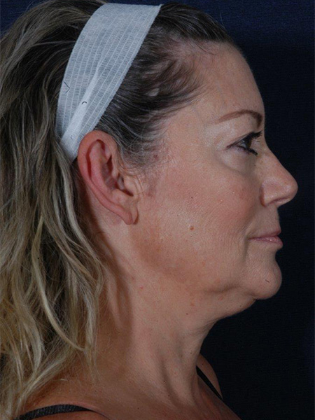 Patient # 62148 Photo 5