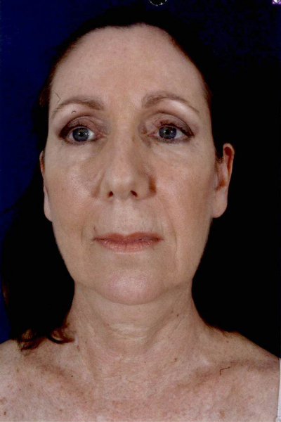Patient # 68956 Photo 3