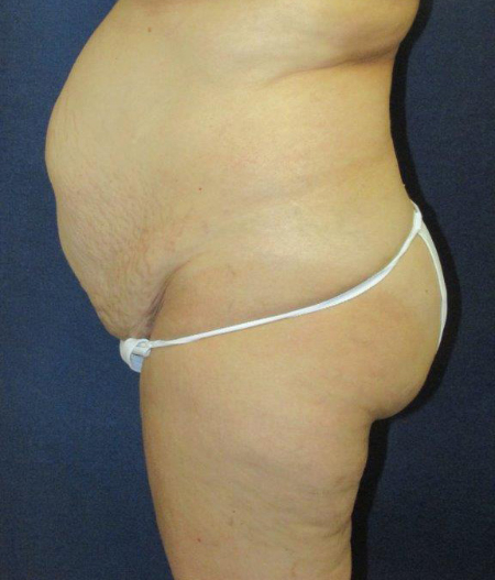 Patient # 40130 Photo 3