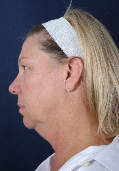 Patient # 78700 Photo 3