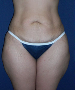 Patient # 25869 Photo 1