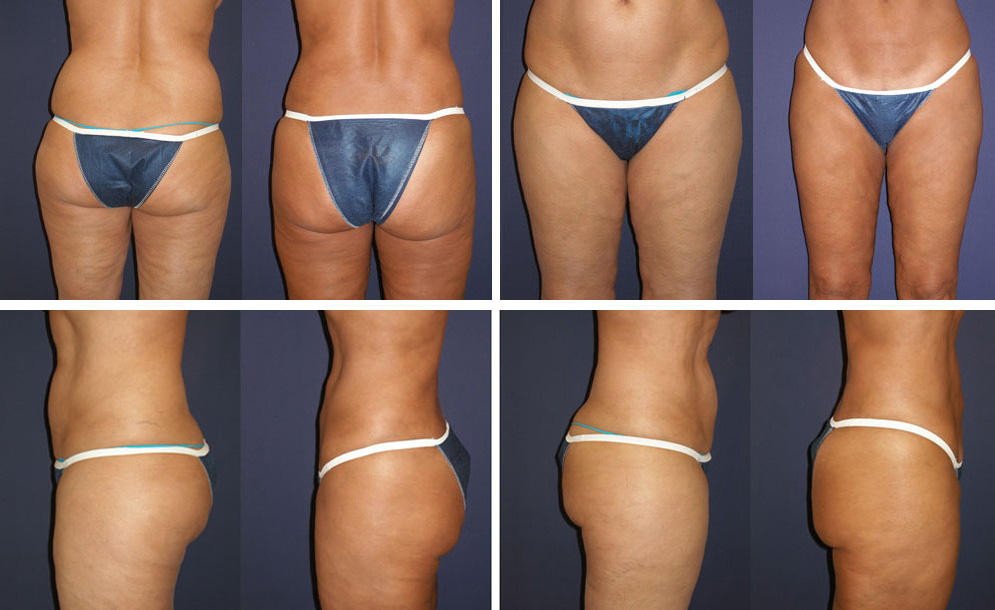 Before and After Image: Patient # 10146 - other