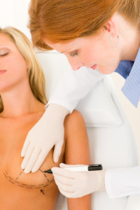 breast augmentation