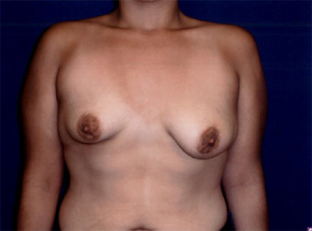 Patient # 82905 Photo 1