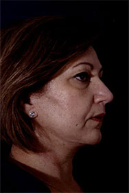 Patient # 17989 Photo 6