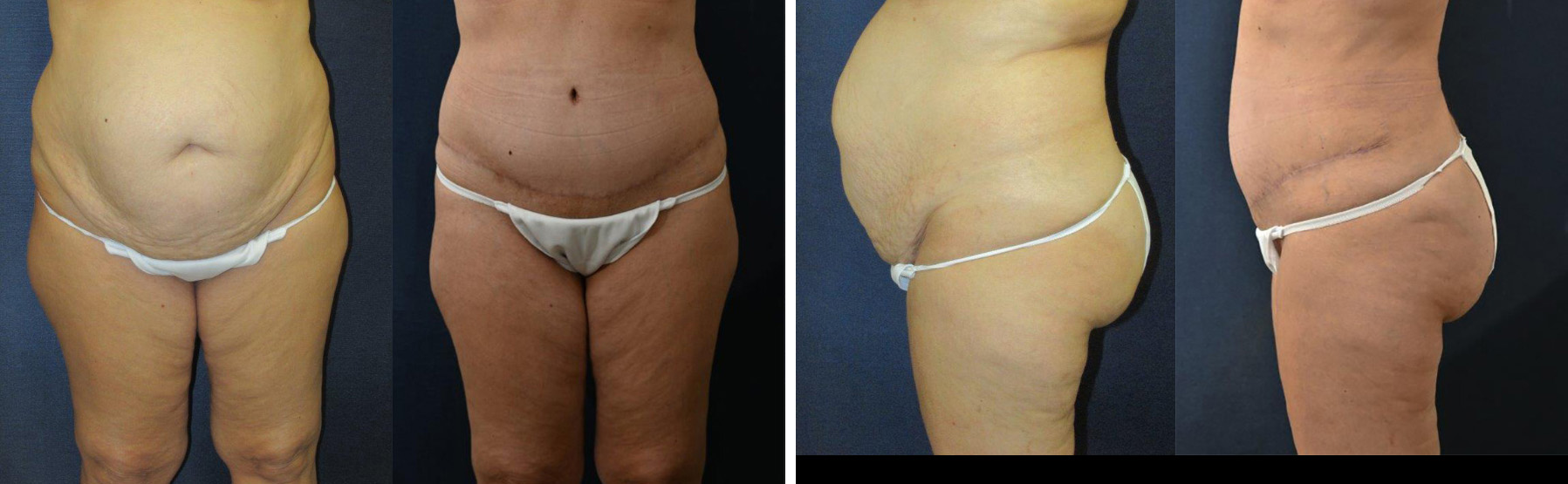 Before and After Image: Patient # 40130 - other
