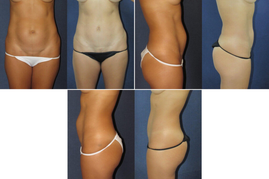 Before and After Image: Patient # 15665 - other