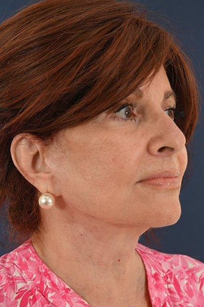 Patient # 67525 Photo 4