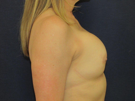 Patient # 17823 Photo 5