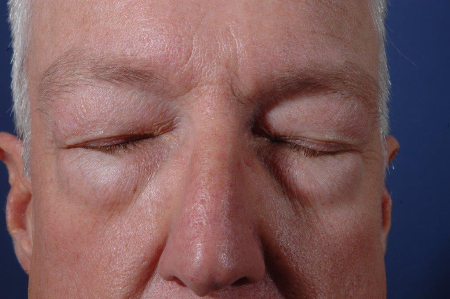 Patient # 90858 Photo 3