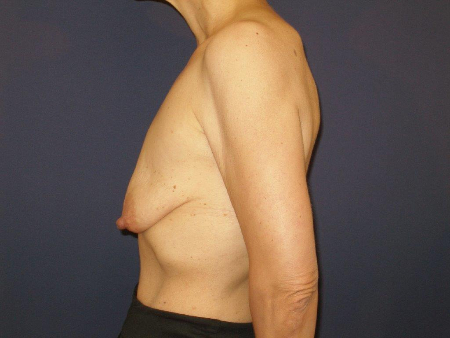 Patient # 84993 Photo 5