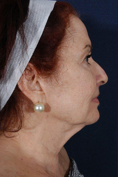 Patient # 67525 Photo 5