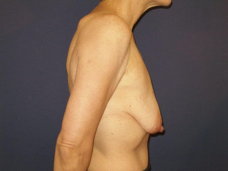 Patient # 84993 Photo 3