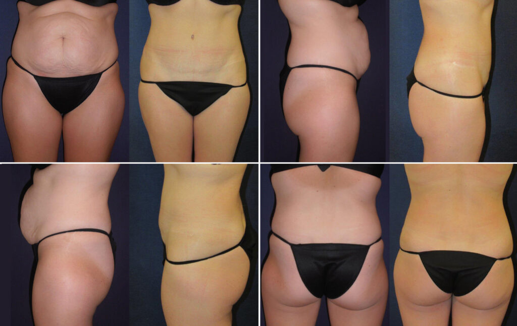Before and After Image: Patient # 23790 - other