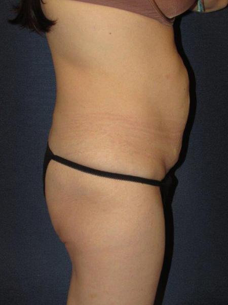Patient # 87707 Photo 3