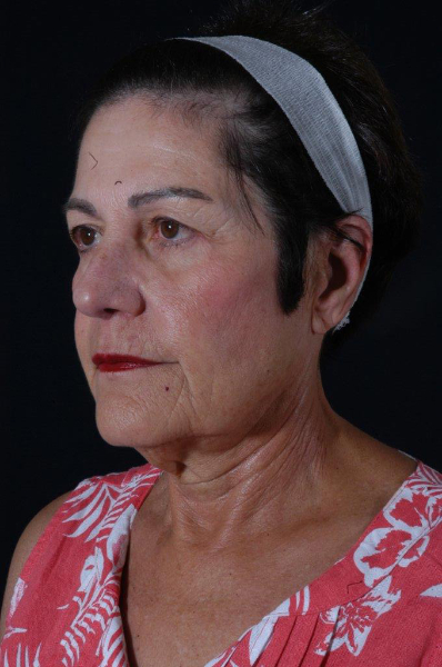 Patient # 58080 Photo 5