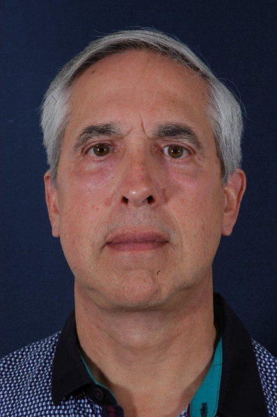 Patient # 24628 After Photo # 2