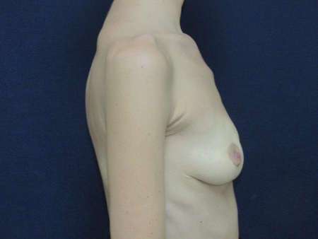Patient # 10010 Photo 6