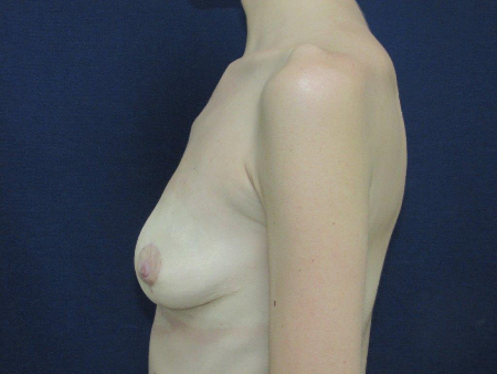 Patient # 10010 Photo 8
