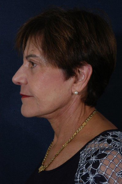 Patient # 58080 Photo 6