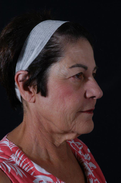 Patient # 58080 Photo 3