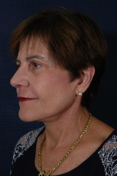 Patient # 58080 Photo 8