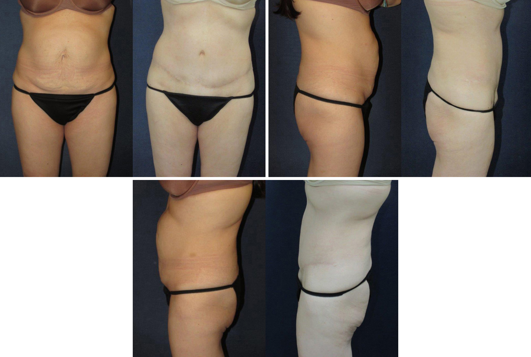 Before and After Image: Patient # 87707 - other