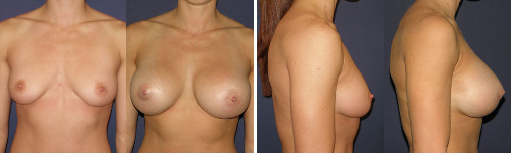 Before and After Image: Patient # 11073 - other