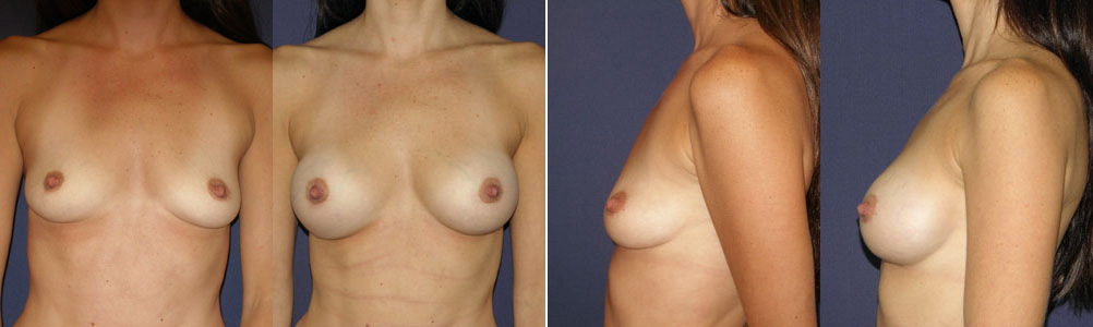 Before and After Image: Patient # 21910 - other