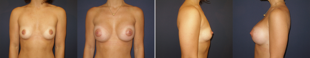 Before and After Image: Patient # 24873 - other