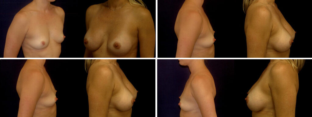 Before and After Image: Patient # 48207 - other
