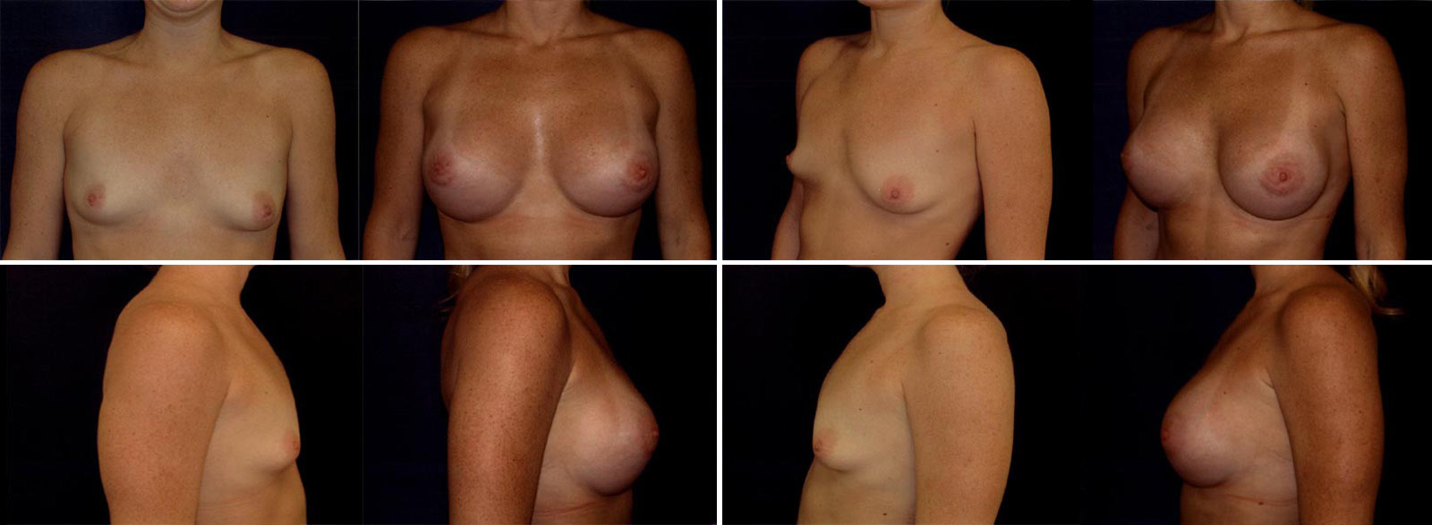 Before and After Image: Patient # 59196 - other