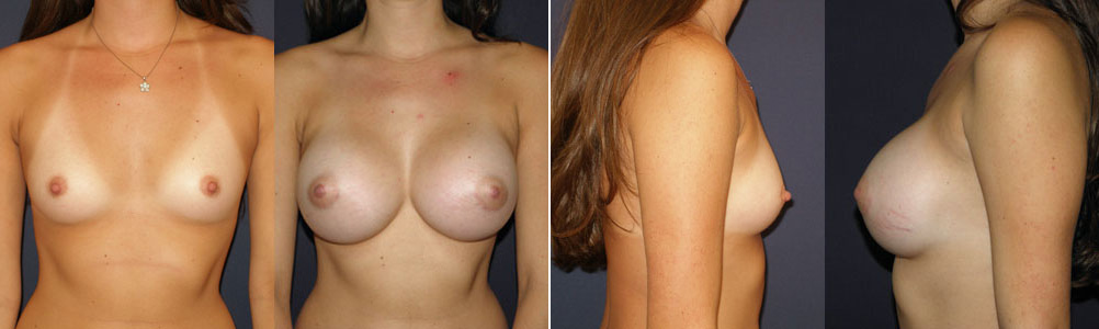 Before and After Image: Patient # 63822 - other