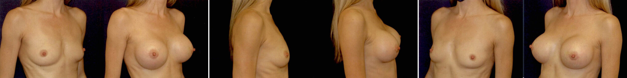 Before and After Image: Patient # 65647 - other