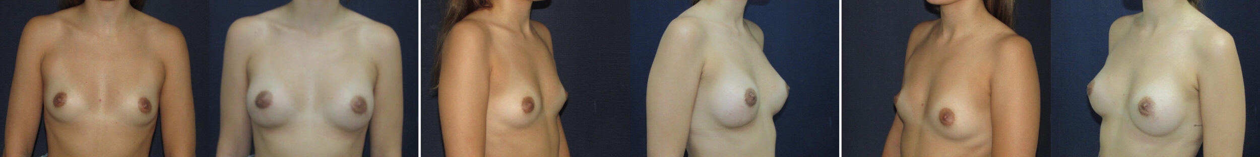 Before and After Image: Patient # 73979 - other