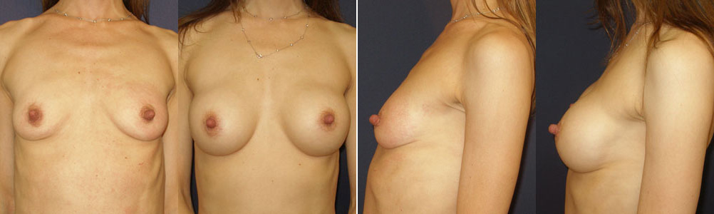 Before and After Image: Patient # 83952 - other