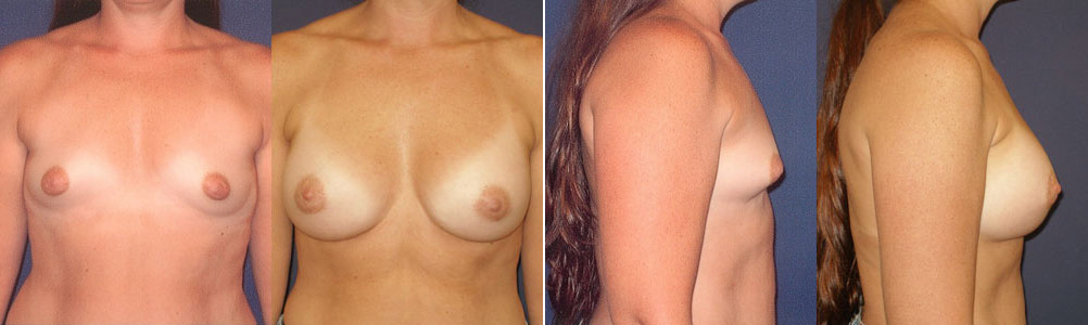 Before and After Image: Patient # 91377 - other