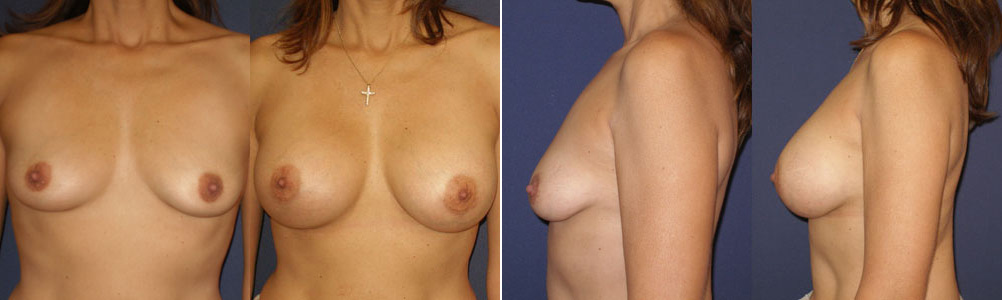 Before and After Image: Patient # 98759 - other