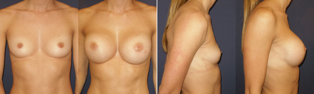 Before and After Image: Patient # 99006 - other