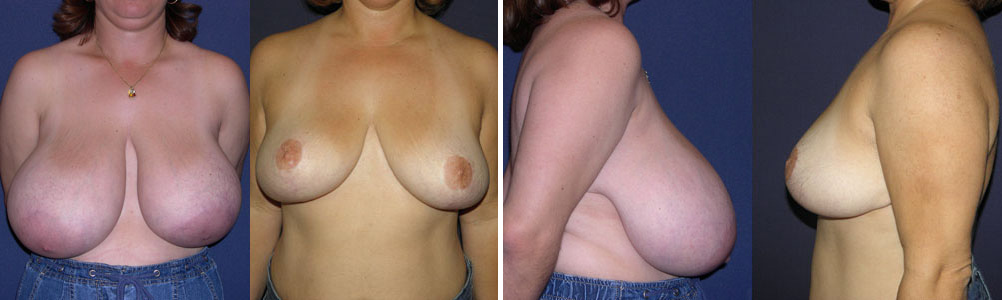 Before and After Image: Patient # 12696 - other