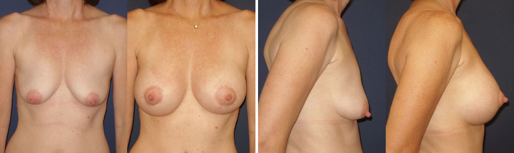 Before and After Image: Patient # 12580 - other