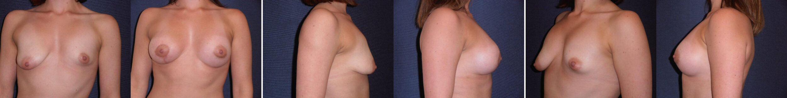 Before and After Image: Patient # 12342 - other