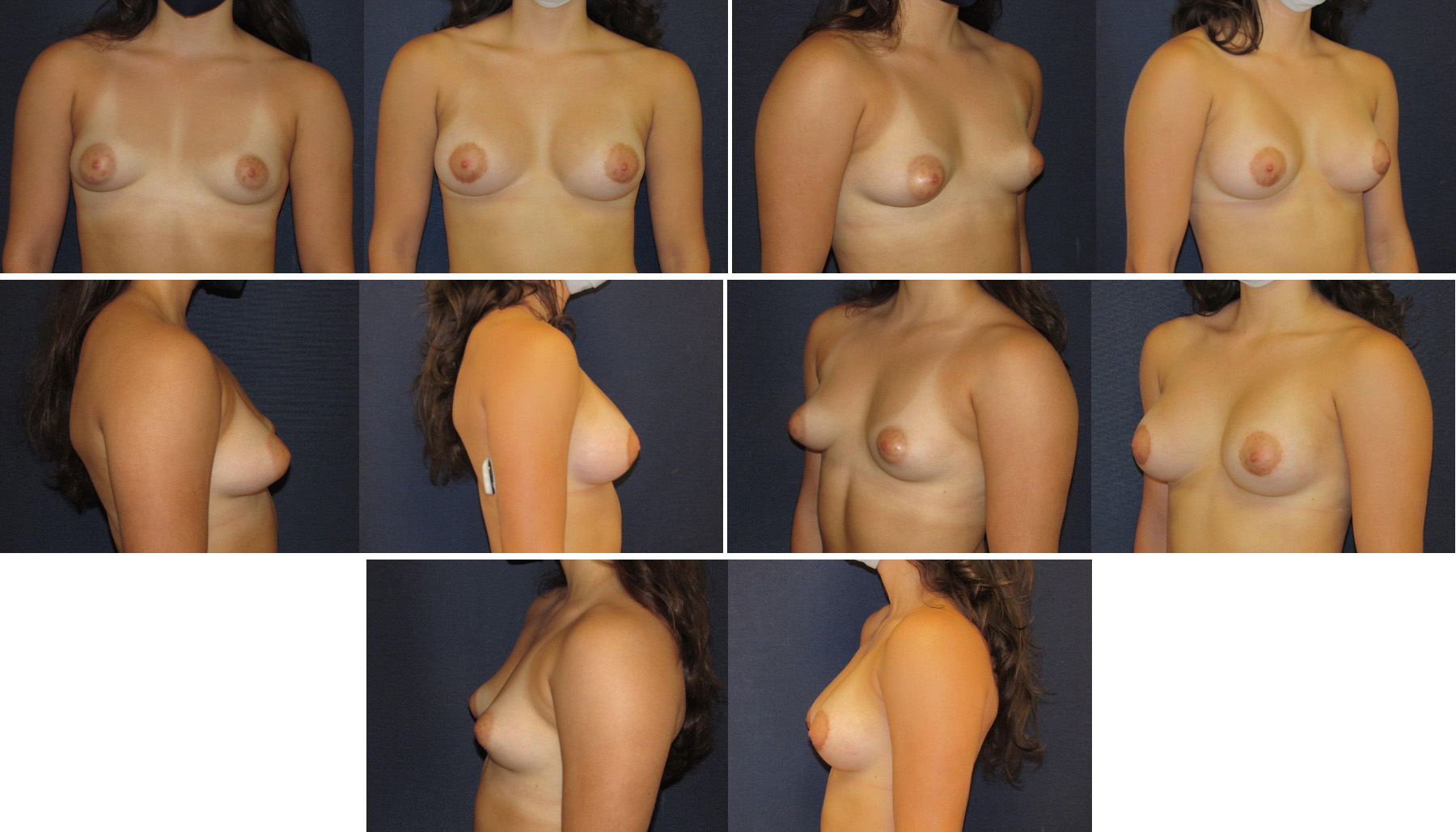 Before and After Image: Patient # 65403 - other