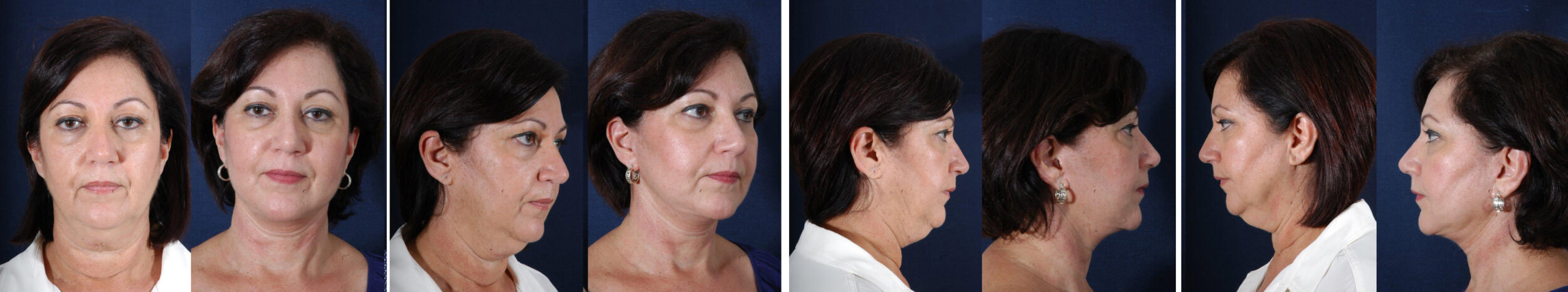 Before and After Image: Patient # 17989 - other