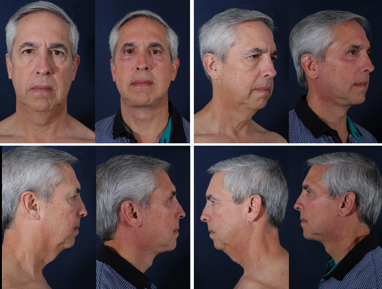 Before and After Image: Patient # 24628 - other