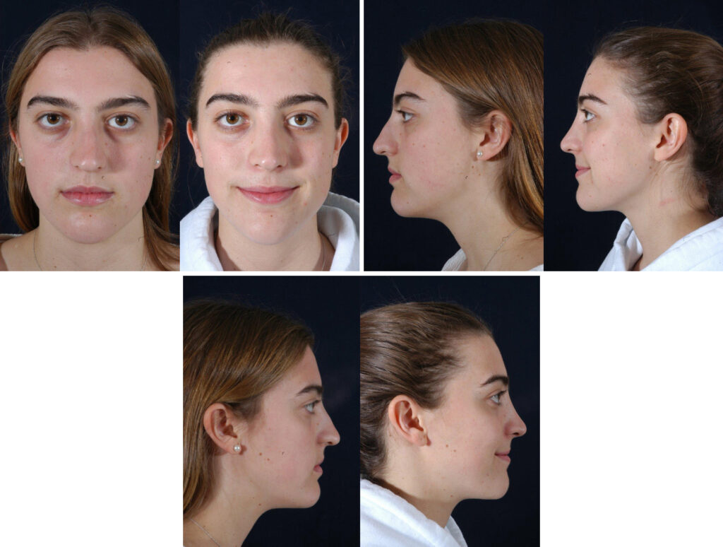 Before and After Image: Patient # 15838 - other