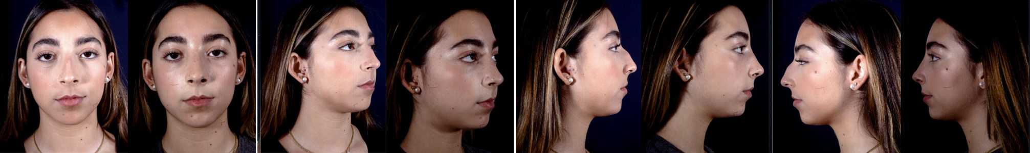 Before and After Image: Patient # 28124 - other