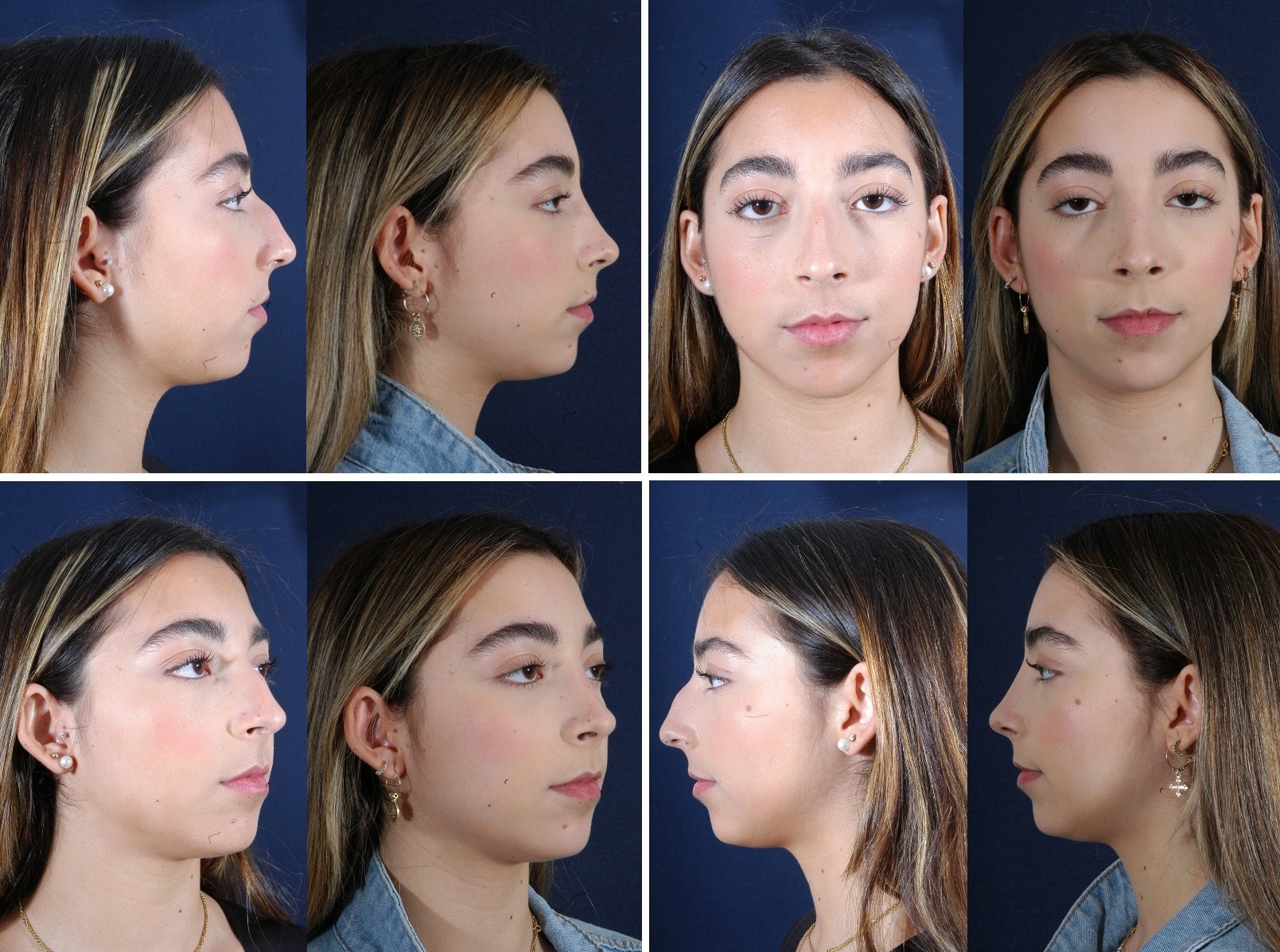 Before and After Image: Patient # 34174 - other