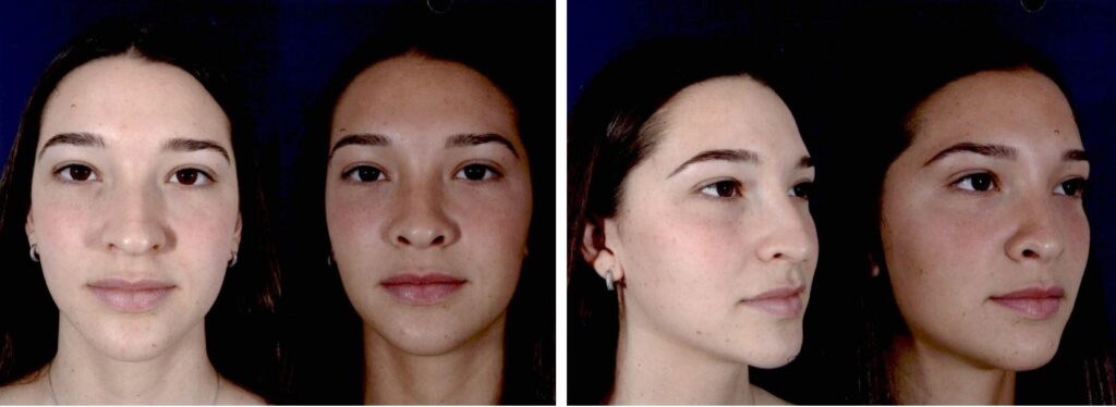 Before and After Image: Patient # 34682 - other