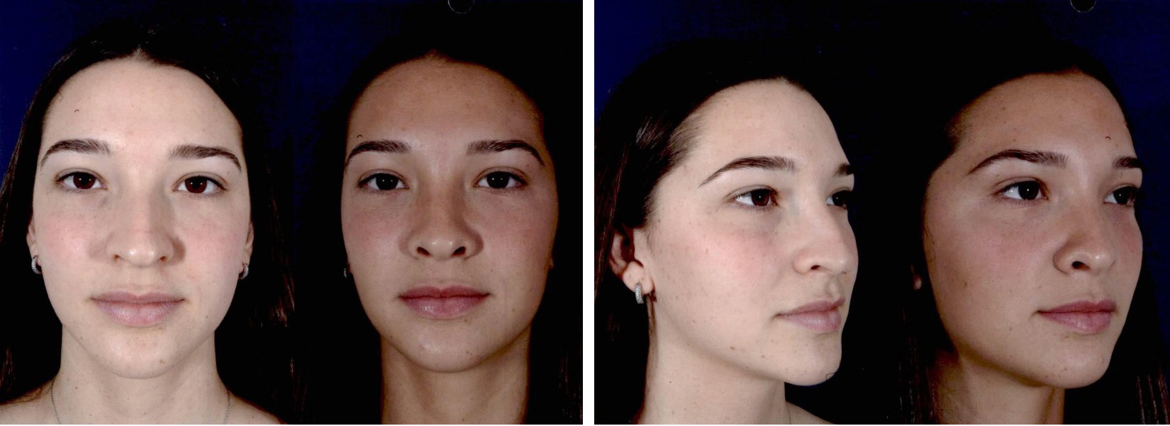 Before and After Image: Patient # 34682 - other